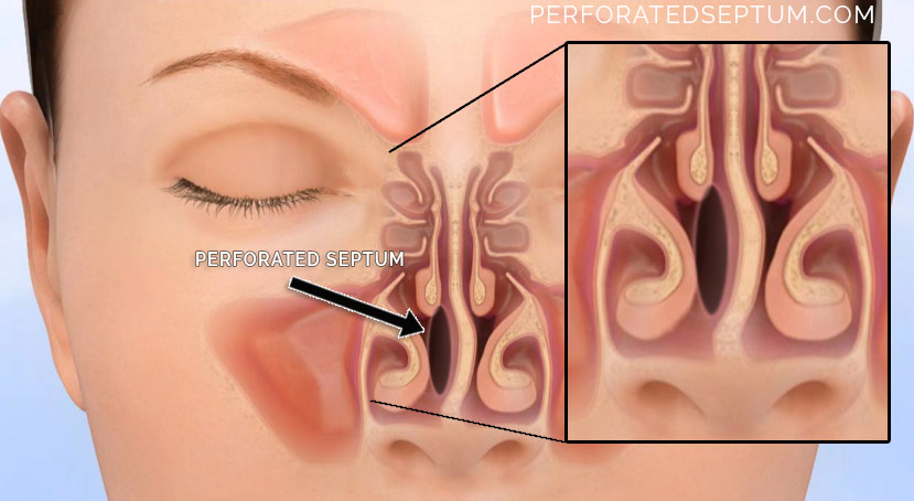 parts of the nose septum